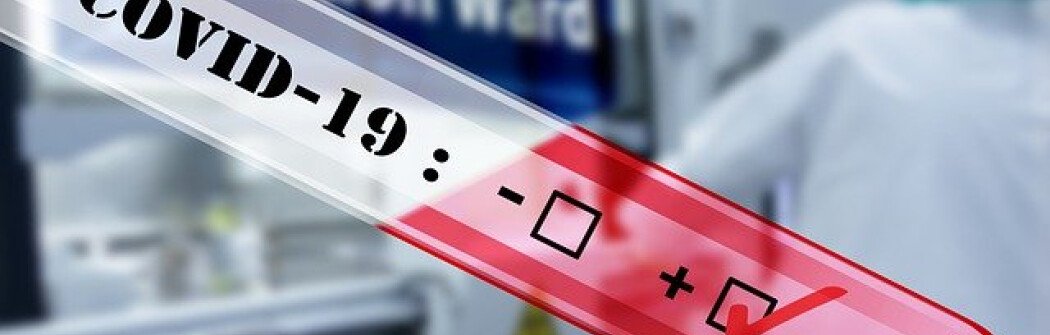 Экспресс-тесты в канадских аэропортах выявляют 70% больных COVID-19 в течение 48 часов
